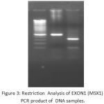 Figure 3: Restriction Analysis of EXON1 (MSX1) PCR product of DNA samples.