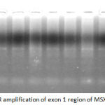 Figure 4: The PCR amplification of exon 1 region of MSX1 of the patients.