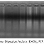 Figure 5: Restriction enzyme Digestion Analysis EXON1 PCR product of DNA sample.