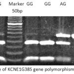 Figure 1: Gel picture of KCNE1G38S gene polymorphism