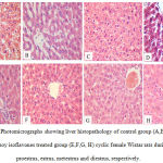 Figure 1: Photomicrographs showing liver histopathology of control group (A,B, C,D) and soy isoflavones treated group (E,F,G, H) cyclic female Wistar rats during proestrus, estrus, metestrus and diestrus, respectively.