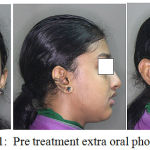 Figure 1: Pre treatment extra oral photos.