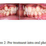 Figure 2: Pre treatment intra oral photos.