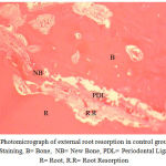 Figure 2: Photomicrograph of external root resorption in control group (X100) H&E Staining, B= Bone, NB= New Bone, PDL= Periodontal Ligament, R= Root, R.R= Root Resorption