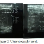 Figure 2: Ultrasonography result.