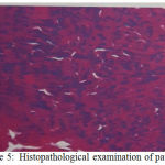 Figure 5: Histopathological examination of patient