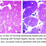 Figure 7: Control Group: a) Day 10 showing developing hepatocytes an sinusoids in between with RBCs b) Day 15, showing well formed hepatic lobules, normal hepatocytes arranged in rows, forming central vein, sinusoids lined by epithelial cells and scattered well-formed RBCs inside the sinusoids.