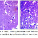 Figure 8: Exposed Group: a) Day 10, showing infiltration of few lipid vacuoles in the hepatocytes and few necrotic hepatocytes b) marked infiltration of lipids causing necrosis of the hepatocytes