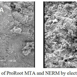 Physical and Chemical Properties of New Endodontic Restorative Material ...