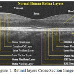 Figure 1: Retinal layers Cross-Section Image.