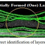 Figure 5: Correct identification of layers highlighted