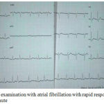 Figure 1: ECG examination with atrial fibrillation with rapid response of rate 110-120 x / minute