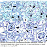 Figure 2a: Section of sham group showed minimal collagen fibers in the glomeruli (G), around Bowman’s capsule (black arrow) and around the proximal (black arrowhead), distal tubules (white arrow); Fig 2(B).