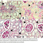 Figure 3a: Section of sham group showed normal reaction of a glomerulus (G), boundaries of Bowman’s capsule (white-arrow), and basement membranes of proximal and distal convoluted tubules (arrowhead).
