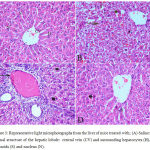 Figure 3: Representative light microphotographs from the liver of mice treated with; (A) Saline: normal structure of the hepatic lobule: central vein (CV) and surrounding hepatocytes (H), sinusoids (S) and nucleus (N).
