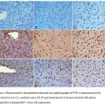 Figure 4: Representative Immunohistochemical microphotographs of TNF-α immunoreactivity from the liver (A–C), cerebral cortex (D–F) and striatum (G–I) of mice treated with saline, haloperidol or haloperidol + stem cell suspension.