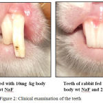 Figure 2: Clinical examination of the teeth