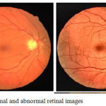 Figure 2a: Normal and abnormal retinal images