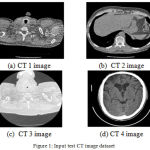 Figure 1: Input test CT image dataset