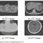 Figure 2: Noisy CT image dataset (σ=25)