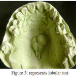 Figure 3: represents lobular tori