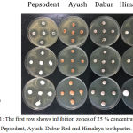 Figure 1: The first row shows inhibition zones of 25 % concentrations of Pepsodent, Ayush, Dabur Red and Himalaya toothpastes.