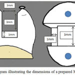 Figure 1: Diagram illustrating the dimensions of a prepared MOD cavity
