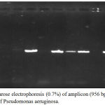 Figure 2: Agarose electrophoresis (0.7%) of amplicon (956 bp) of 16S rDNA gene of Pseudomonas aeruginosa.