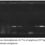 Figure 4: Agarose electrophoresis (0.7%) of amplicon (397 bp) of exoA gene of Pseudomonas aeruginosa.
