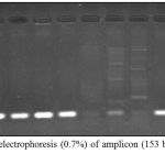 Figure 8: Agarose electrophoresis (0.7%) of amplicon (153 bp) of lasB gene of P. aeruginosa.