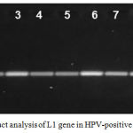 Figure 1: PCR product analysis of L1 gene in HPV-positive samples.