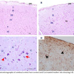 Figure 1: Photomicrographs of cerebral cortex from control and Cur treated mother rats showing A & B)