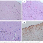 Figure 4: Photomicrographs of cerebral cortex from Pb and Cur-treated mother rats showing: A)