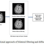 Figure 1: Combinational approach of bilateral filtering and diffusion filter