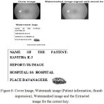 Figure 8: Cover Image, Watermark image (Patient information, thumb impression), Watermarked image and the Extracted image for the correct key.