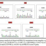Figure 1: Sequence analysis of observed PIK3CA mutations in our samples: a) H1047Q (c.3141T>A), (b) H1047Y (c.3139C>T), c) H1048Q (c.3144T>G) of PIK3CA exon 20 gene and (d and E) E545K (c.1633G>A) of PIK3CA exon 9 gene.