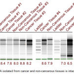 Figure 1: RNA isolated from cancer and non-cancerous tissues is intact.