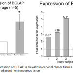 Figure 2: Expression of BGLAP is elevated in cervical cancer tissues compared to adjacent non-cancerous tissue.