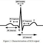 Figure 2: Characterization of ECG signal