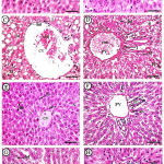 Figure 1: Photomicrographs of maternal liver displayed A&B (control group).
