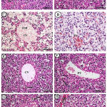 Figure 2: Photomicrographs of fetal liver displayed A&B (control group): A&B (control group).