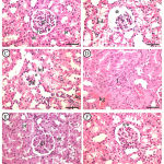 Figure 3: Photomicrographs of maternal kidney displayed A&B (control group).