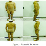 Figure 1: Picture of the patient