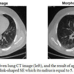 Figure 2: One slice of a given lung CT image (left), and the result of applying the morphological filtering which utilizes a disk-shaped SE which its radius is equal to 5.