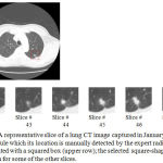 Figure 4: A representative slice of a lung CT image captured in January 2000, comprising a single nodule which its location is manually detected by the expert radiologists and demonstrated with a squared box (upper row); the selected square-shaped area is magnified and shown for some of the other slices.