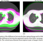 Figure 6: Visualization of the differences between the first captured image and its follow-up version (a); Visualization of the differences between the registered version of the follow-up image and the first captured image (b); The colored areas illustrate those regions in pair of images where the gray-levels are different.