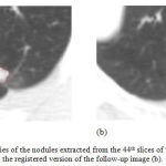 Figure 7: The boundaries of the nodules extracted from the 44th slices of the first image (a) and the registered version of the follow-up image (b).