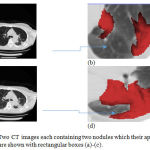 Figure 8: Two CT images each containing two nodules which their approximate locations are shown with rectangular boxes (a)-(c).
