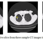 Figure 9: One representative slice from three sample CT images taken from the RIDER database.
