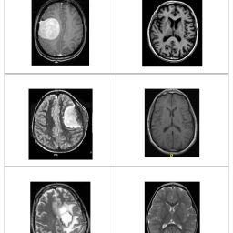 Brain Tumor Classification Using Convolutional Neural Networks ...